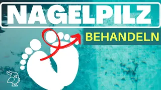 🚀NAGELPILZ NATÜRLICH BEHANDELN🚀 12 Hausmitel gegen Nagelpilz. Nagelpilz Behandlung leicht gemacht