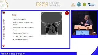 ERS Thessaloniki 2021, Round Table 1: Frontal Sinus Surgery