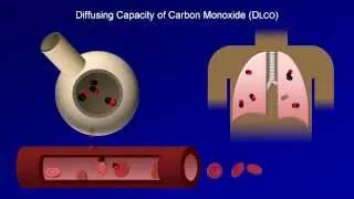 Pulmonary Function Tests (PFT): Lesson 4 - DLCO