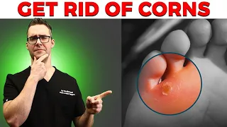 Calluses, Foot Corns & Plantar Wart Removal [Top 10 Home Remedies]