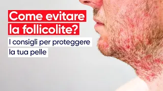 Come evitare la follicolite? I consigli per proteggere la tua pelle