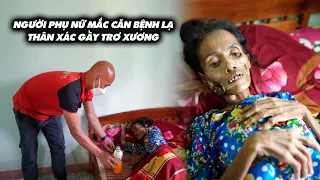 NGƯỜI PHỤ NỮ MẮC CĂN BỆNH LẠ, THÂN XÁC GẦY TRƠ XƯƠNG