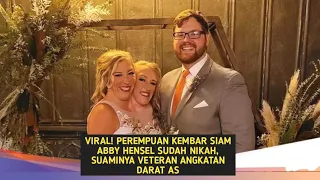 Viral WANITA KEMBAR SIAM ASAL Minnesota SUDAH Menikah❤️