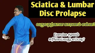 sciatica/disc herniation causes &treatment in tamil/medical awareness in tamil