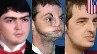 This woman sees dead brothers face on transplant recipient