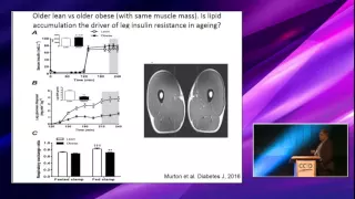 Physiological approaches to study the science of human sedentariness- Session 4: Paul Greenhaff