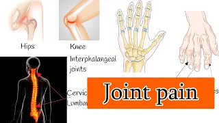 Osteoarthritis - Joint Pain and Stiffness,  Osteoarthritis Symptoms and treatment