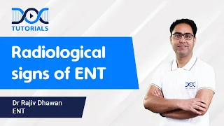 Radiological Signs of ENT | Dr Rajiv Dhawan | NEET PG & FMGE | DocTutorials