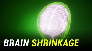 Why Your Brain is Shrinking?