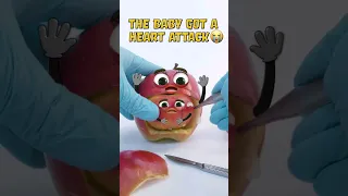 Baby Apple gets HEART ATTACK during fruit surgery BUT...😱💔 #shorts #fruitsurgery #cute