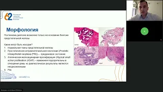 Подготовка к экзамену ESMO: стандарты лечения рака предстательной железы