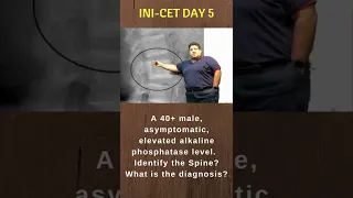 INI-CET Rapid Revision by Dr. Tushar Mehta | INI-CET, NEET PG, NEXT | #shorts