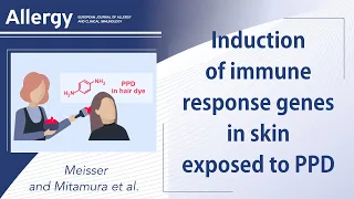 Regulation of immune response genes in the skin of  individuals exposed to p-phenylenediamine