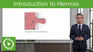 Hernia: Introduction – General Surgery | Lecturio