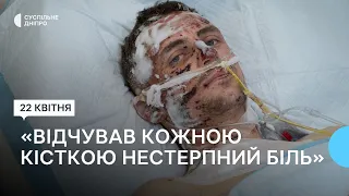 «Вижив, бо витягнули побратими»  Військового з численними пораненнями лікують на Дніпропетровщині