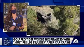 Tiger Woods hospitalized with 'multiple leg injuries' after car crash