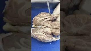 Brain Dissection Pt 2   Sheep