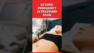 Ectopic Pregnancy Ultrasound Scan