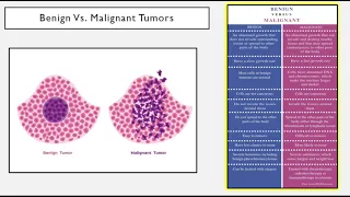 Pathophysiology Lecture 2 - Neoplasia