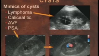 Practical Reviews in Ultrasound Kidneys & Adrenals