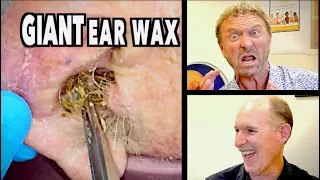 DOCTORS REACT TO VIRAL EARWAX REMOVAL (feat. Auburn Medical Group)