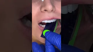 Finalmente Você vai Saber pra quê o Dentista Usa Isso!!! #shorts