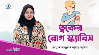 স্ক্যাবিস থেকে মুক্তির উপায় - Scabies Treatment Bangla