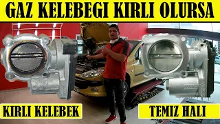 Gaz Kelebeği Kirli Olursa Ne Olur? Boğaz Kelebeği Temizliği Faydaları