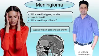 Meningioma: Symptoms, Treatment. Most common benign brain tumor. Things U should know. By Dr Skanda