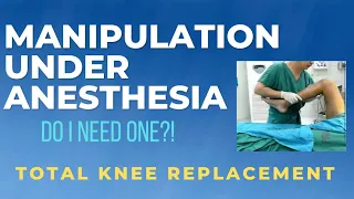 Manipulation Under Anesthesia (FULL DETAILS) Total Knee Replacement