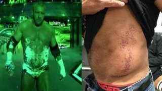 Triple H s Entrance Accident | Wrestlemania 29 | Triple h vs Brock lesner| Ice accident