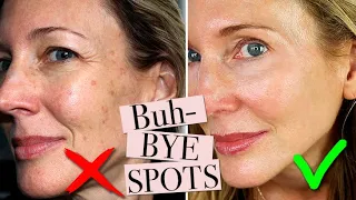 How To Get Rid of Age Spots!