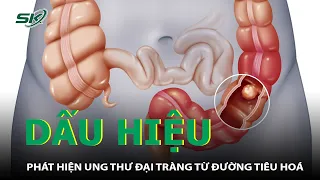 Phát Hiện Ung Thư Từ Dấu Hiệu Bất Thường Của Đường Tiêu Hóa | SKĐS