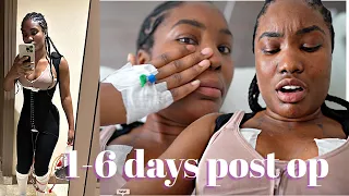 VLOG: 1-6 days POST OP 😰  LIPOSUCTION + BREAST LIFT .. ya'll I'm in PAIN