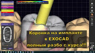 коронка на импланте. exocad. подробное видео с курса. Цирконий. Обучение зубных техников!