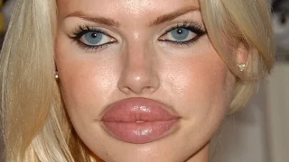 10 PLASTIC SURGERY GONE WRONG