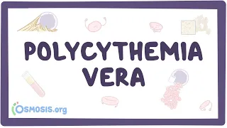 Polycythemia vera - causes, symptoms, diagnosis, treatment, pathology