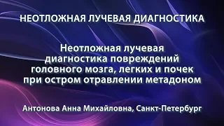 Антонова А.М. - Неотложная лучевая диагностика повреждений при остром отравлении метадоном