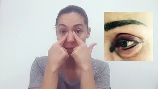 Peligros de tatuarse la raya de ojo, o eyeliner micropigmentacion de linea de ojo