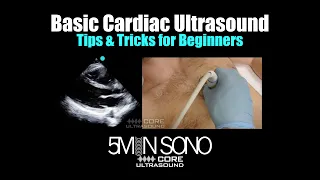 Basic Cardiac Ultrasound: Tips and Tricks for Beginners