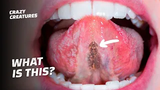 The Creepy Parasite That Eats Tongues