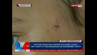 Batang ginahasa umano ng isang lalaki, may sakit at nakararanas ng matinding takot