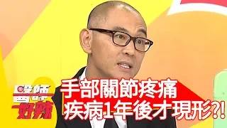 手部關節疼痛，疾病1年後才現形？！【醫師好辣】20200203 part1 EP886 賈蔚 陳保仁