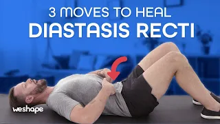 3 Moves To Heal Diastasis Recti