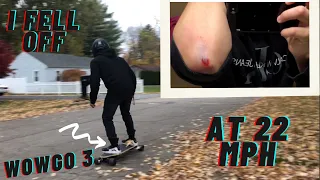 I FELL OFF MY ELECTRIC LONGBOARD AT 22MPH