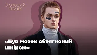 Танцівник Дорофєєвої вперше про всі подробиці страшного побиття | Зірковий шлях