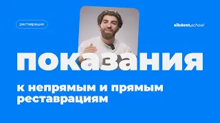 Показания к непрямым и прямым реставрациям. Погосян Айк. Выпуск 8. aikdent.school