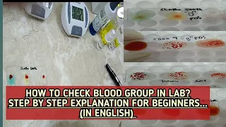 How to check blood group in lab?Step by step explanation in an easy way in English. Forward grouping