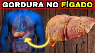 😱 COMO ACABAR DE VEZ COM A GORDURA NO FÍGADO? O que COMER e o  que NÃO COMER? (Esteatose Hepática)