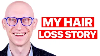 My Alopecia Areata Journey | Dr. Gary Linkov